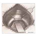 Dark Union Hollywound